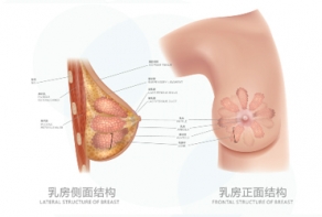 产后乳房修复